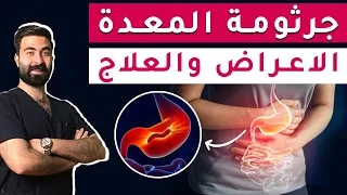 اعراض جرثومة المعدة كيف تتخلص من جرثومة المعدة بشكل نهائي ماهو السبب الخفي لألم البطن المستمر 