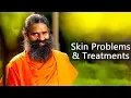 Skin Problems Treatments Swami Ramdev