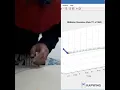 IMU Simulation of Gaining Position from Acceleration Data Square Version