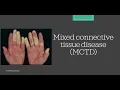 Download Lagu MCTD (Mixed Connective Tissue Disease) [Essential medicine]