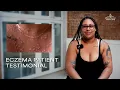 Teya s Eczema Story It s a Complete 180