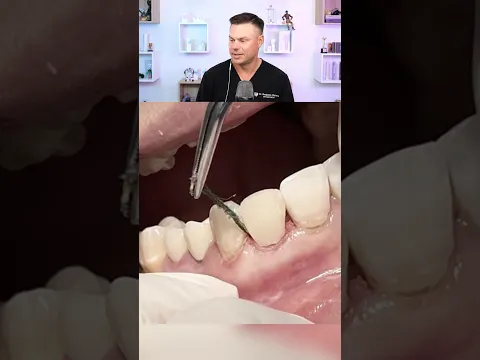Dentist Reacts To Tooth Restoration! 😮🦷
