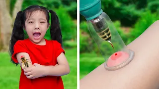 Mẹo Sơ Cứu Thông Minh Dành Cho Bố Mẹ | Mẹo Sơ Cứu Khẩn Cấp Cho Bé