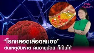 อาการของโรคหลอดเลือดสมองมีอะไรบ้าง