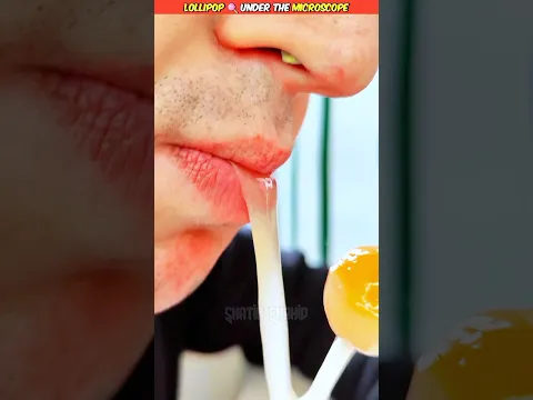 🔴लॉलीपॉप पर लगी लार और मिट्टी को माइक्रोस्कोप में देखा 🧐