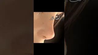 انواع الانوف 