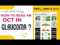 HOW TO READ AN OCT PRINTOUT IN GLAUCOMA STEPWISE EXTREMELY EASY PART - 2