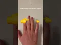 Dose bruising mean broken fingers comment