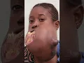 Lagu 😔💔 Menina do Congo enfrenta um tumor gigante na sua mandíbula 🙌🏽💉 #MeuCorpoMeuDesafio