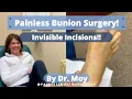Recovering from Bunion Surgery