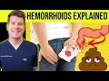 Doctor explains HEMORRHOIDS aka piles Causes symptoms treatment prevention