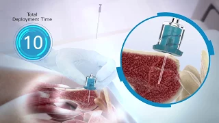 NIO Intraosseous Adult 