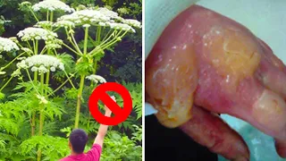 Download The Most Dangerous Plants in the World MP3