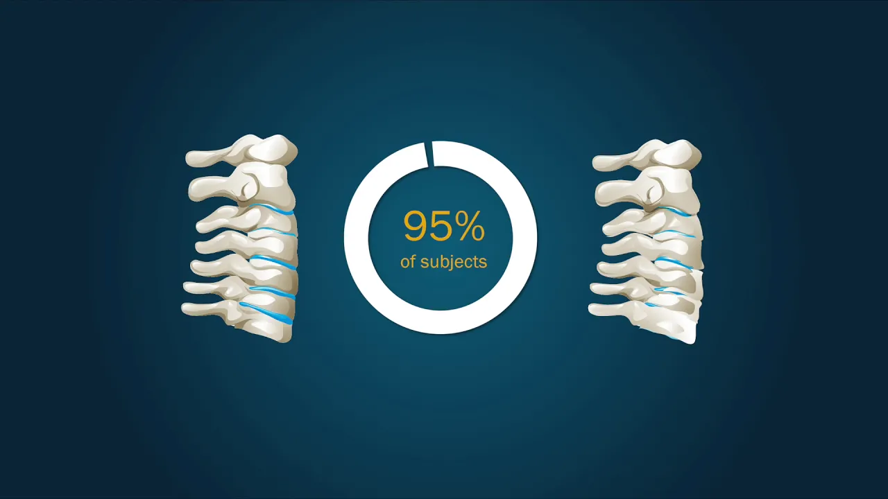 What are the best non-surgical ways to treat a cervical herniated disc? Try McKenzie therapy as an a. 