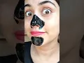 Download Lagu DIY Blackheads \u0026 Whiteheads at home 💯 | #shorts #youtubeshorts #trendinghacks #blackheads  #short