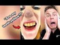 Download Lagu Yellowest Teeth In The World VS Orthodontist