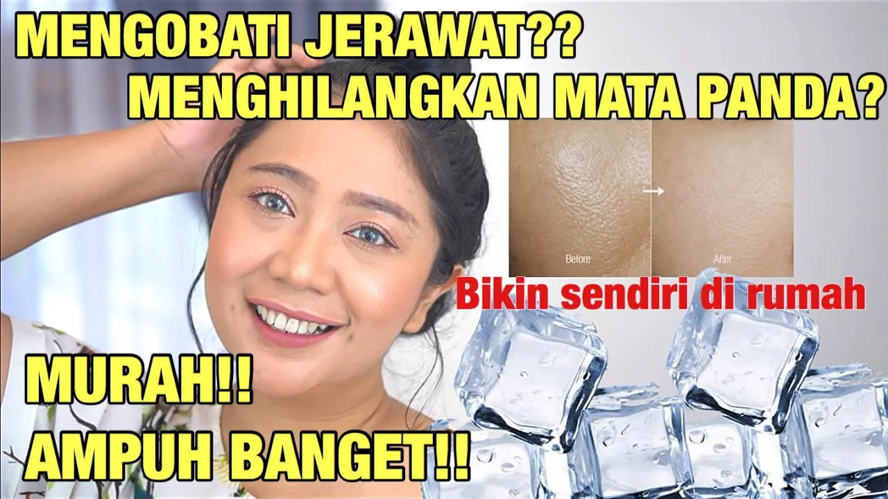 BEKAS JERAWAT HILANG DONG | DENGAN ES BATU - AMPUH!!