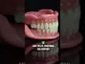 Easy Denture At - Home Dentures