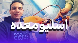 اسلیو معده جراحی لاغری Sleeve 