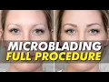 Microblading Before After Eyebrow Tattoo Transformation Eye Design NY