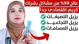 الكريم المنقذ ارخص كريم لمنع التصبغات و البقع والتجاعيد و المسام الواسعة 