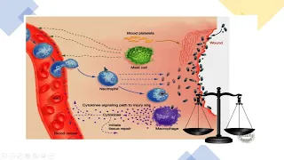 Inflamação aguda e crônica