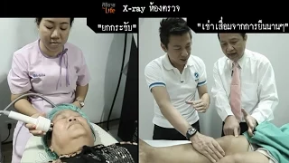 ผิวหน้าหย่อนคล้อยเกิดจากอะไร