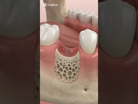 لما تفقد سن!🤔 ؟؟
