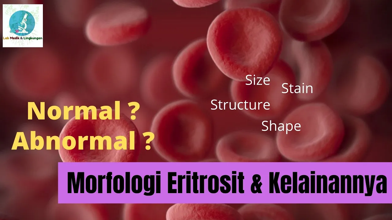 MORFOLOGI ERITROSIT DAN KELAINANNYA :