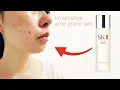 SKII Made Me Breakout How I Healed My Sensitive Acne-Prone Skin