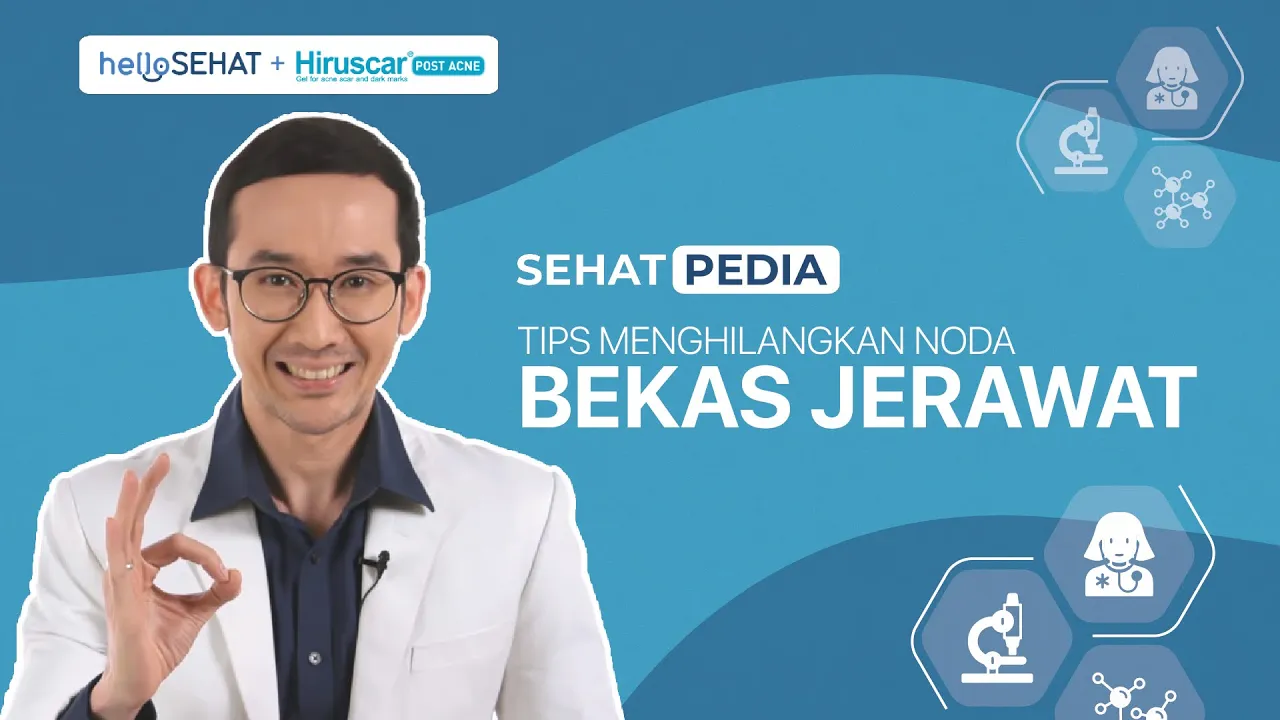 
          
          
          
            
            Tips Menghilangkan Noda Bekas Jerawat
          
        . 