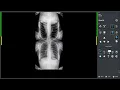 VXvue - Stitching Overview