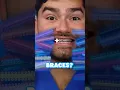 What s the Best Braces Color
