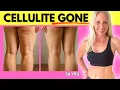 Download Lagu How to Get Rid of Cellulite for Good | My Leg Transformation at 56