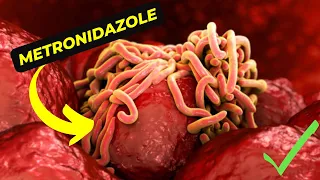 Download Metronidazole: A Comprehensive Guide to Uses, Dosage, and Possible Side Effects MP3