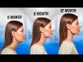 Download Lagu 1 YEAR MEWING RESULTS!How to get defined cheekbones WITHOUT surgery?