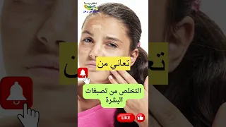 تخلصي من حروق الشمس وتصبغات البشرة في أسبوع واحد 