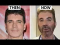 Simon Cowell NEW LOOK Plastic Surgery Analysis