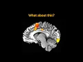 OSU Workshop Part 1 fMRI Pitfalls