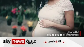 أسباب آلام الظهر عند الحامل برنامج التشخيص 