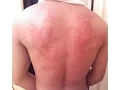 Premier Allergy Reviews - Interesting Allergy and Asthma Facts