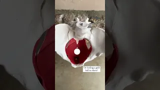 Tight Pelvic Floor Pain With Bowel Movements 