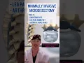 Minimally Invasive Microdiscectomy - EXPLAINED