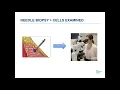 October 12 2021 Smilow Shares Greenwich Breast Cancer - Exploring Treatment Options