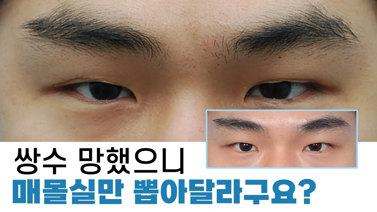 잘못된 수술 방법입니다.