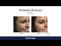 Ideal Image MedSpa - The Advanced MedSpa