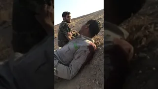 اقوى معركه بين الحشد الشعبي وداعش اصابه احد ابطال الحشد الشعبي ولم ينسحب  اقوى معركه بين الحشد الشعبي وداعش اصابه احد ابطال الحشد الشعبي ولم ينسحب