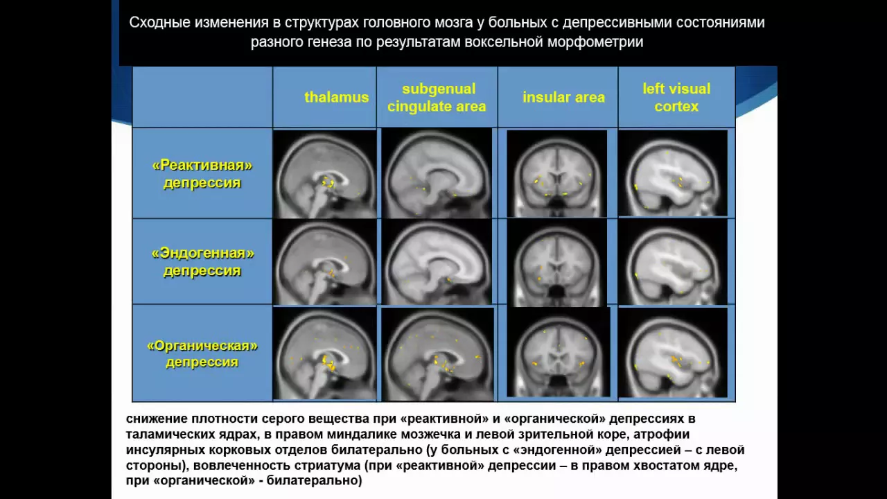 Соколов А.В. «Функциональная МРТ в оценке когнитивных функций»