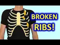 Download Lagu 6 Do’s \u0026 6 Don’ts To Recover From Broken Ribs