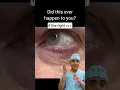 Is Your Eyelid Twitching Here s the Fix